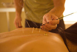 Èãëîóêàëûâàíèå äëÿ ëå÷åíèÿ îñòåîõîíäðîçà Èãëîóêàëûâàíèå äëÿ ëå÷åíèÿ îñòåîõîíäðîçà