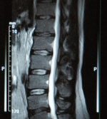 Магнитно-резонансная томография (МРТ)