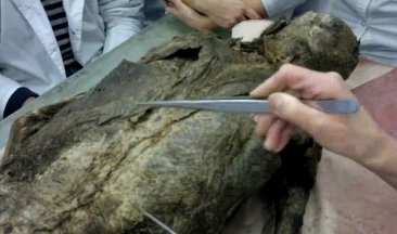 Анатомия мышц спины