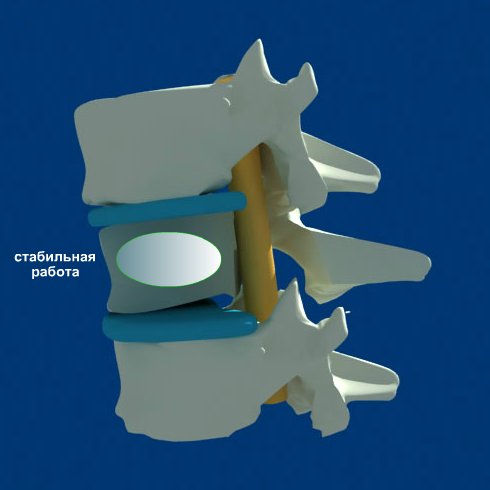 Операции на позвоночнике