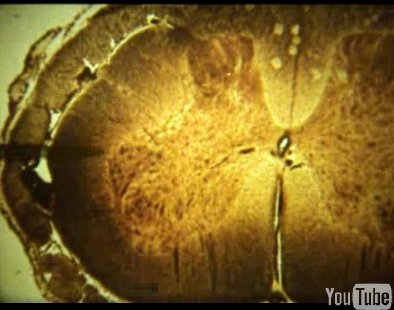 Видео, обучающие фильмы о строении и функциях спинного мозга